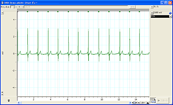 HRV